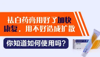 白斑用什么药膏治疗好得快