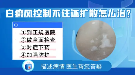 白癜风吃药抹药控制不住还在扩散怎么办