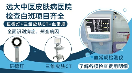 伍德灯和皮肤镜检查白斑的区别