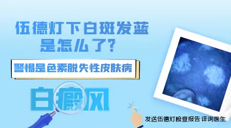 伍德灯下白癜风和普通白斑颜色对比图详解