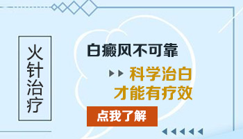 扎火针治疗手上白癜风民间小偏方