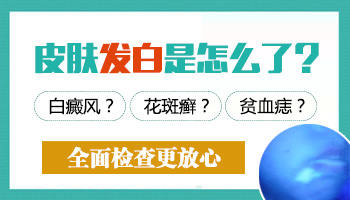 儿童皮肤发白是不是得了白癜风