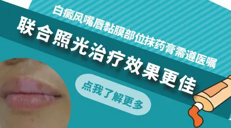 嘴唇上白癜风用芦可替尼乳膏怎么样