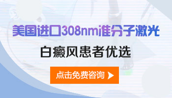 308激光照白癜风间隔多久照一次好