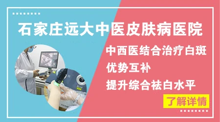 伍德灯结果显示白斑呈瓷白色是不是很难治