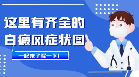 白癜风是淡白色的还是瓷白色的