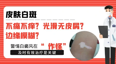 腰上长了一块白块不痛不痒要紧吗