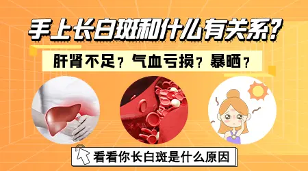 手上的白斑是不是比脸上的白斑更难复色