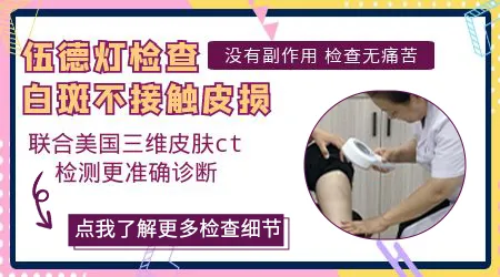 伍德灯检查白斑后皮肤发痒正常吗