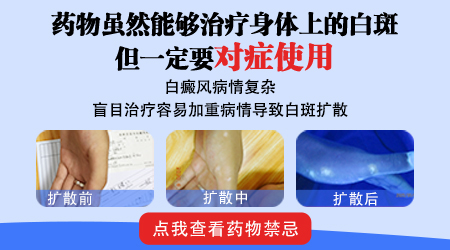 白癜风治疗过程中发红发痒是正常的吗