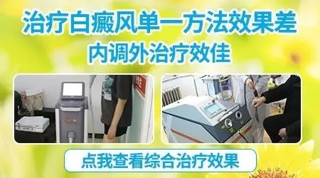 芦可替尼和他克莫司哪个治白癜风好