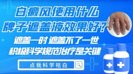 白癜风遮瑕膏选哪个牌子的好