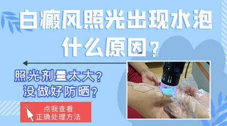 白癜风照308激光后皮肤发红起水泡是剂量太大吗