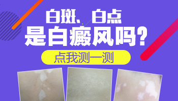 宝宝大腿内侧色素不均有点白是什么