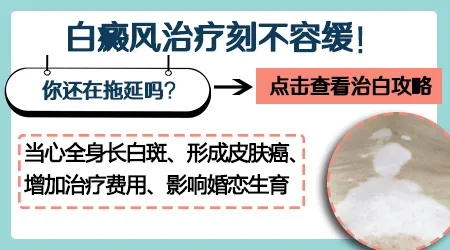 白癜风和炎症后色素减退要怎么区分