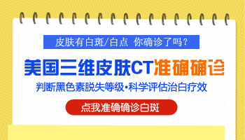 8岁儿童白斑早期图片  辨别白斑的方法