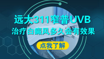 长期用uvb311照白癜风可以吗