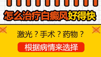 对称形白癜风如何治疗效果好