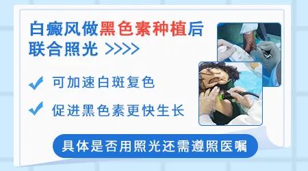 白癜风手术复色不理想还有哪些补救手段