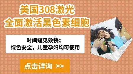 石家庄哪家医院看儿童白癜风靠谱
