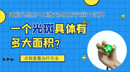 白癜风照308激光是按什么收费