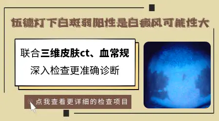 伍德灯检查白斑弱阳性能确诊吗