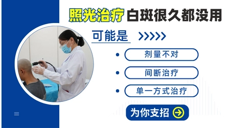 白斑照光效果不大该怎么治