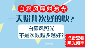 308激光多久照一次白癜风比较好