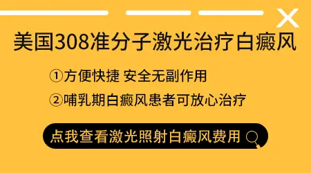 308激光照射白癜风有什么优势