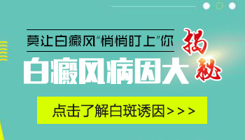 手指白癜风是不是和经常摩擦皮肤有关系