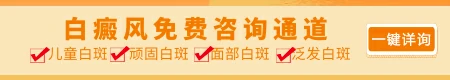 白癜风患者使用哪种遮盖剂效果好