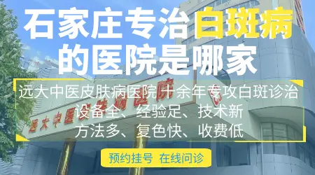 uvb光疗仪治疗白癜风显得严重了