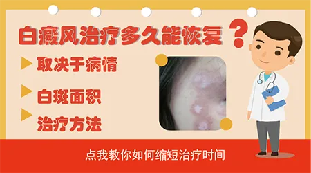 白癜风治疗多久才能控制不扩散