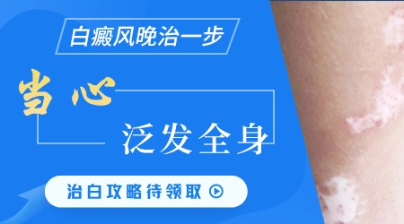 白癜风初期能治好的几率有多大 会不会复发