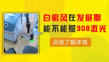 发展期白癜风用308激光能控制住吗