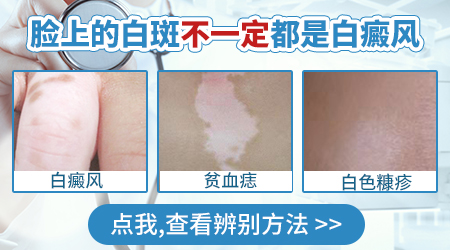 脸上长了一小块白斑不疼不痒
