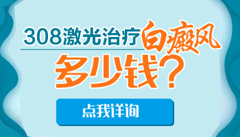 308一次多少钱 照激光能治好白癜风吗