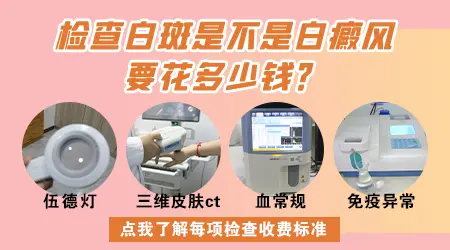 脖子白斑早期症状
