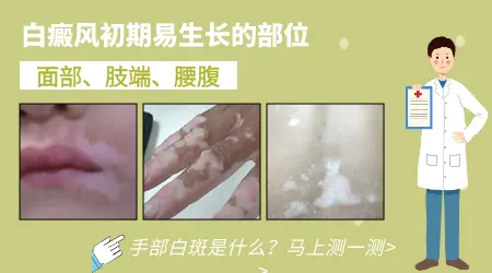 白癜风初期是什么样图片