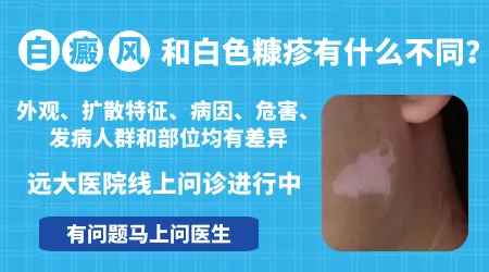 白色糠疹和白癜风症状区分图片