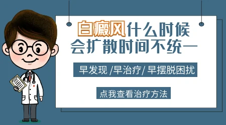 白癜风一年没扩散还会不会扩散