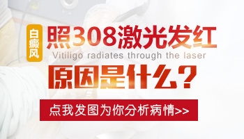 白癜风用308连续照两天红肿是不是量大了