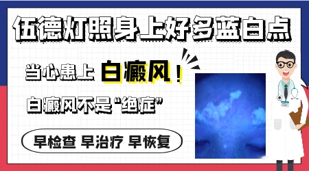 白色块在伍德灯下亮蓝白代表什么