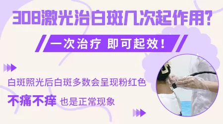 使用308激光照白癜风效果会不会好