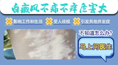 白斑扩散后有哪些伤害