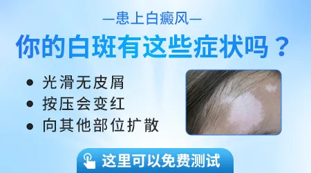 脸上突然白了一小块是白癜风吗
