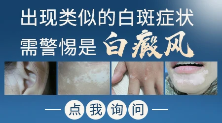 女士嘴角有一小块白色皮肤怎么回事