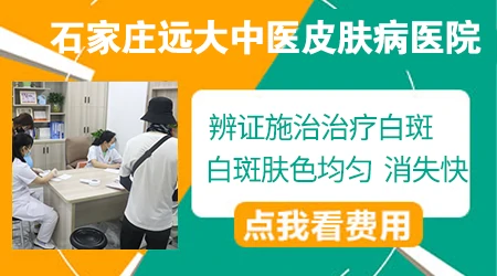 新冠之后得白癜风怎么治