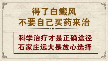 白癜风遮盖液可以抹嘴唇吗