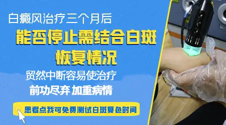面部白癜风治疗3个月能复色吗